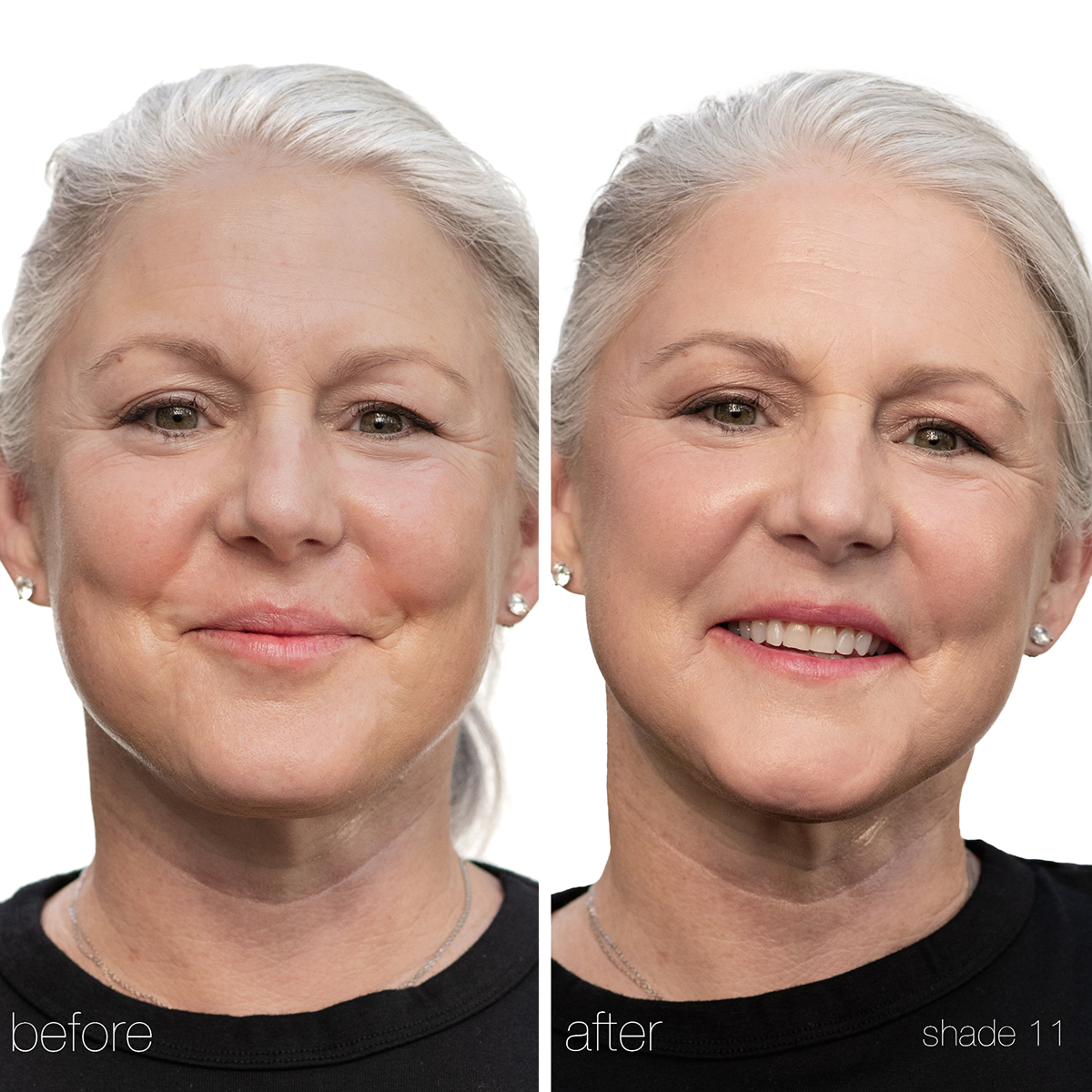 RMS Beauty - UnCoverup Concealer