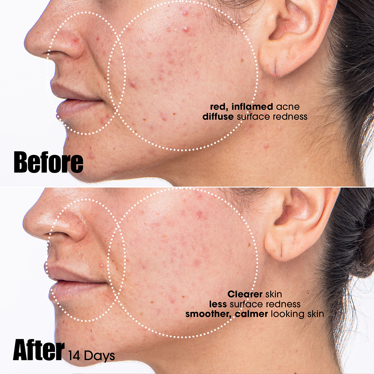 Sunday Riley - Peacekeeper Salicylic + Azelaic Serum
