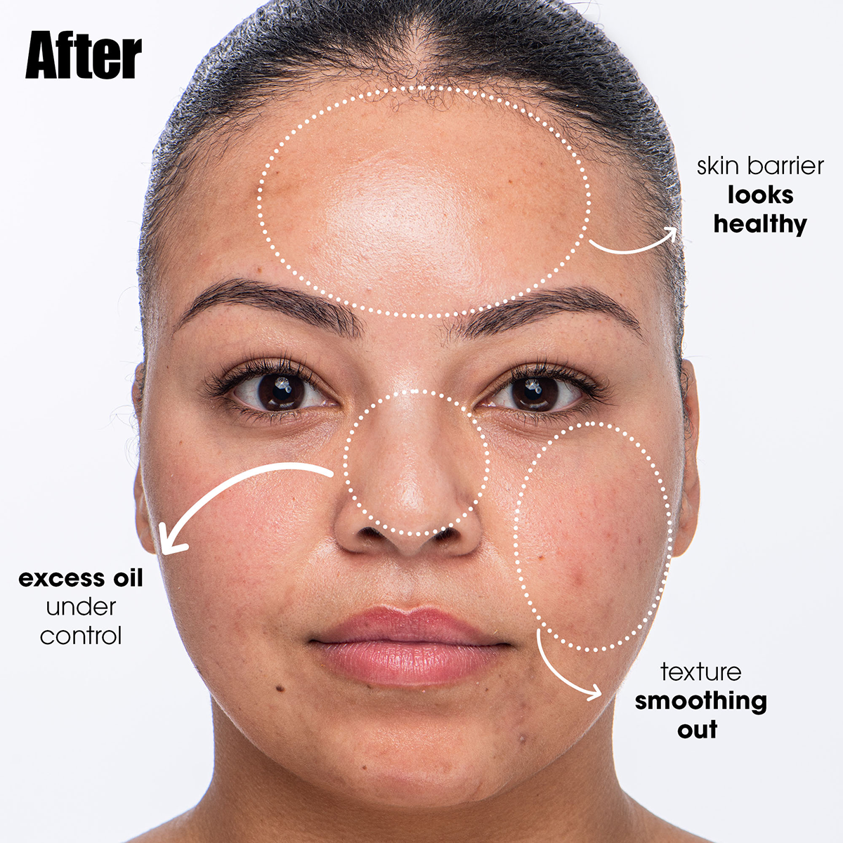 Sunday Riley - Breakout Breakup Purifying Cleanser