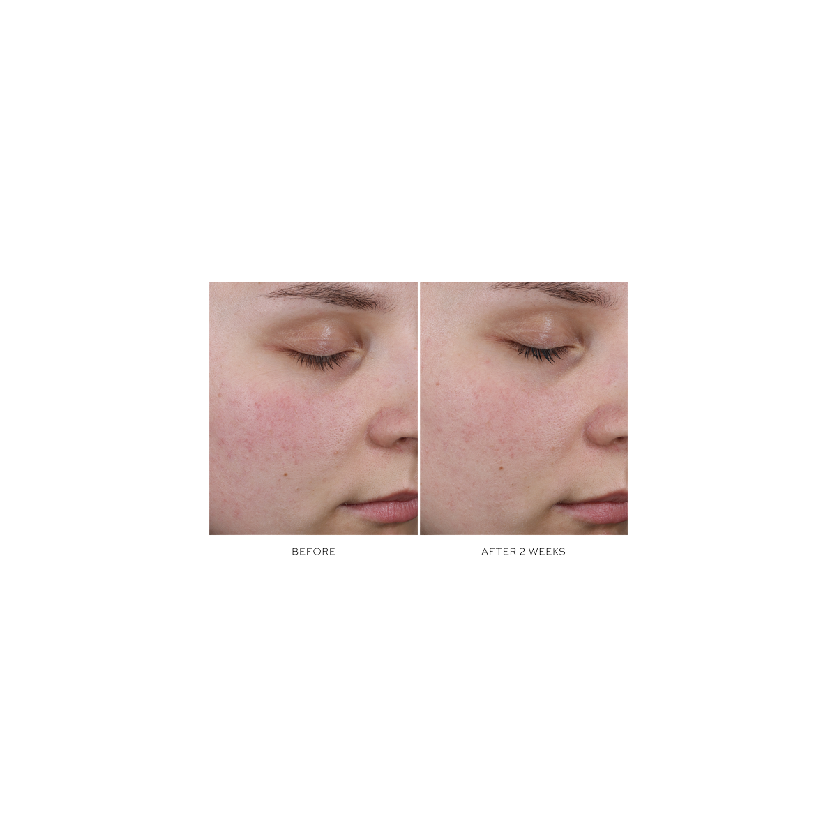 Westman Atelier - Pore Refining Complex Serum