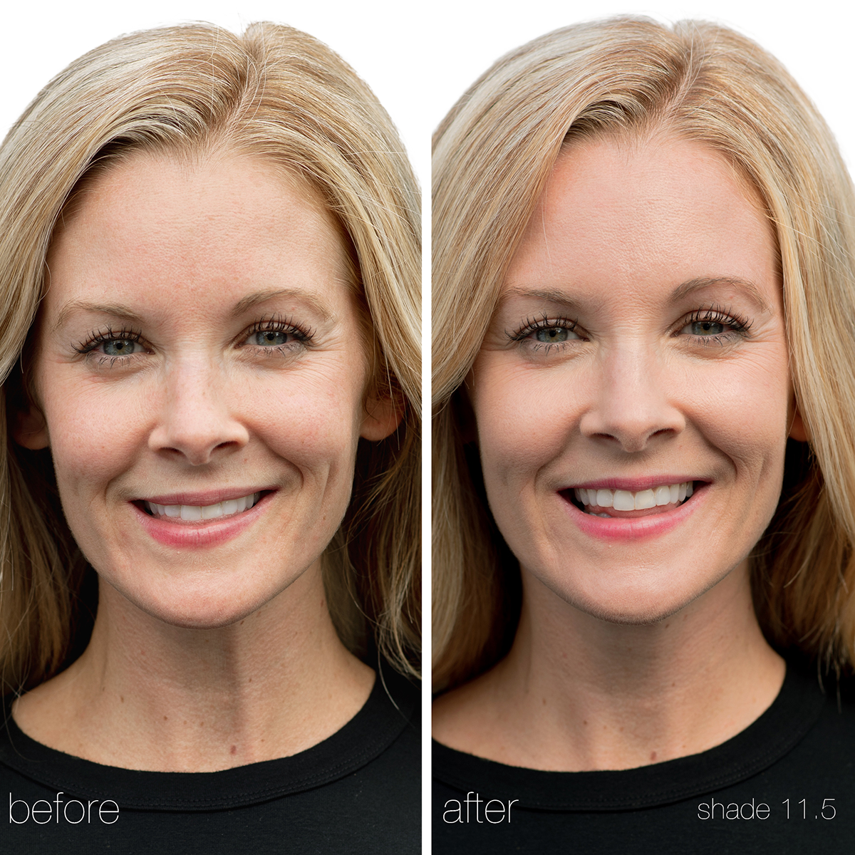 RMS Beauty - UnCoverup Concealer
