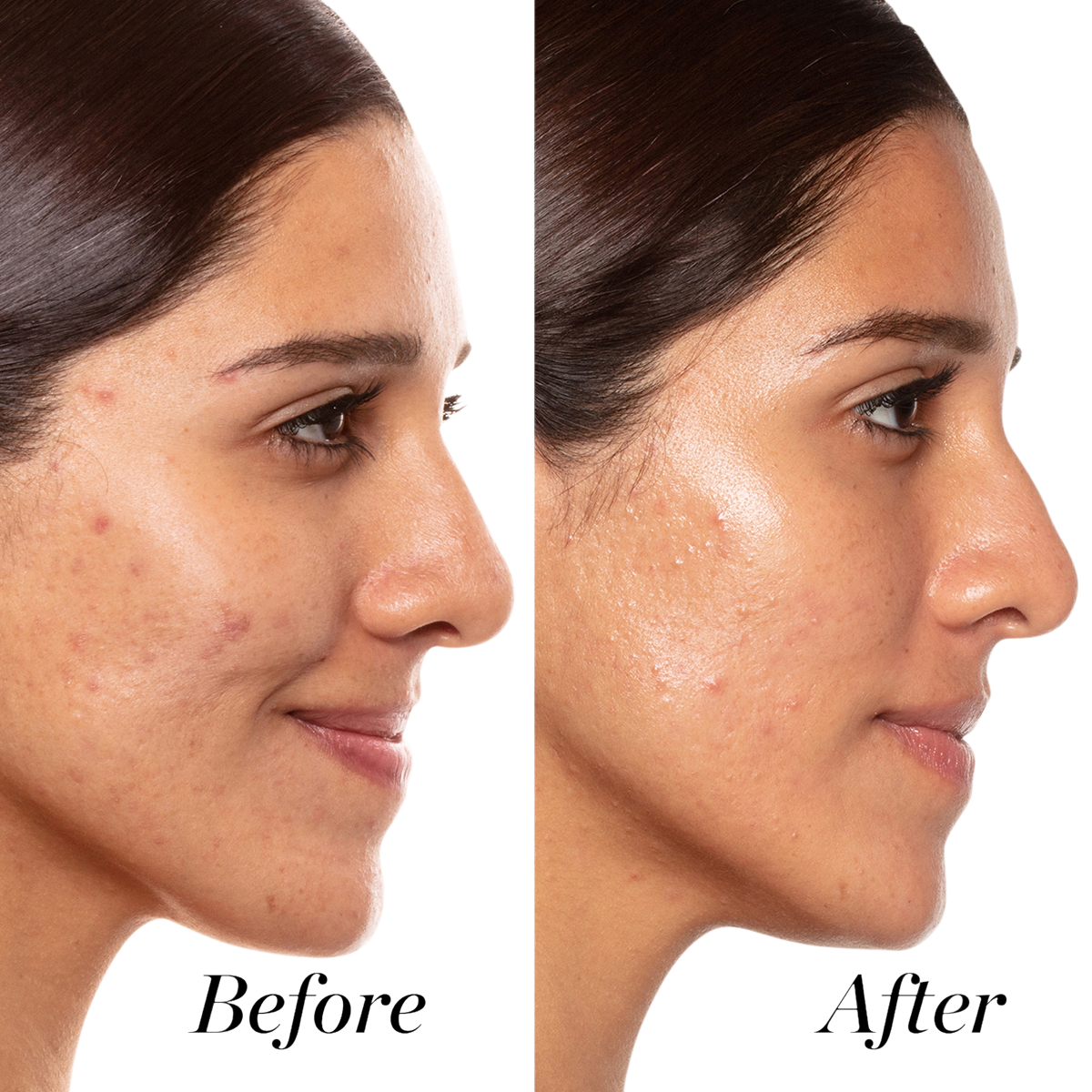 Sunday Riley - A+ High-Dose Retinoid Serum